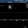 Dormed Hellas S7-2_8 TEE Cardiology