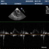 Dormed Hellas S8-3_7 Phased Array Cardiology