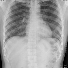 Dormed Hellas X-RAY 60kv 2mA 0.5sec