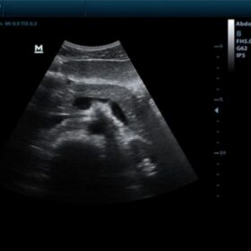 Dormed Hellas DP-50 - Pancreas