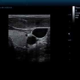 Dormed Hellas DP-50 - Thyroid