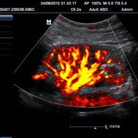 Dormed Hellas M7 - Renal Power-1