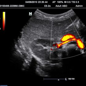 Dormed Hellas M7 - Renal Power