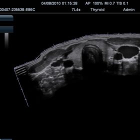 Dormed Hellas M7 - Thyroid