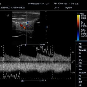 Dormed Hellas M7 - Thyroid Doppler