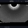 Dormed Hellas Aloka UST-9118_5 Endocavity