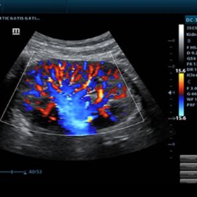 Dormed Hellas DC-30 - Color Flow of Kidney