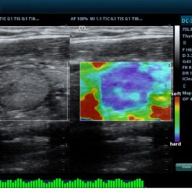 Dormed Hellas DC-30 - Elasto