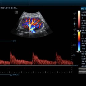 Dormed Hellas DC-30 - Pulse Wave of Kidney