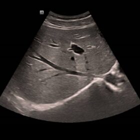 Dormed Hellas DC-40FHD - Kidney