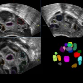 Dormed Hellas DC-40FHD - Smart FLC