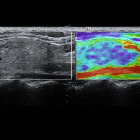 Dormed Hellas Mindray DC-40 Full HD