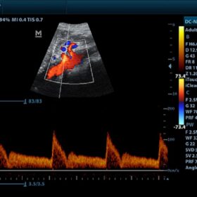 Dormed Hellas DC-N2 - Celiac Axis PW