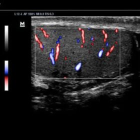 Dormed Hellas DC-N3 PRO