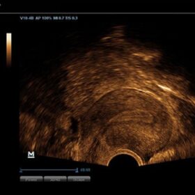 Dormed Hellas DC-N3 - Uterus