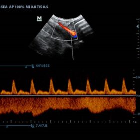 Dormed Hellas Z50 - Feline Iliac Artery and Vein PW
