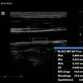 Dormed Hellas Z50 - IMT-Messure
