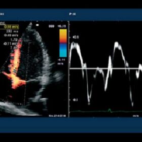 Dormed Hellas 6500HV - Cardio TDI