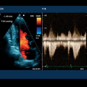Dormed Hellas 6500HV - Cardio color Doppler