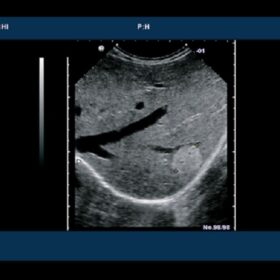 Dormed Hellas 6500HV - Liver
