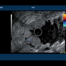 Dormed Hellas 7000HV - Radial Electronic Endoscope