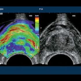 Dormed Hellas 7000HV - Urology Prostate