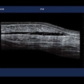 Dormed Hellas 7000HV - Wide View