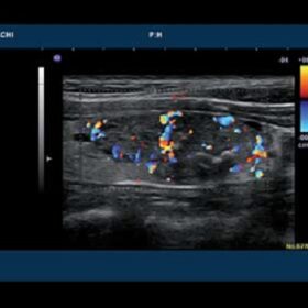 Dormed Hellas 7500HV - Color Flow