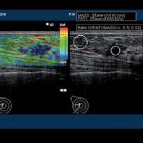 Dormed Hellas 7500HV - Elasto Breast