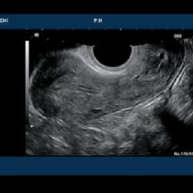 Dormed Hellas 7500HV - Gynecology