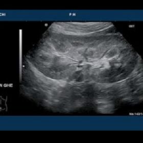 Dormed Hellas 7500HV - Pediatric Kidney