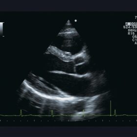 Dormed Hellas A10 - Cardio