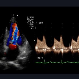 Dormed Hellas A10 - Cardio Color Doppler