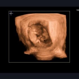 Dormed Hellas A10 - Fetal Vaginal