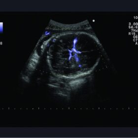 Dormed Hellas A10 - Obstestric