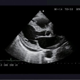 Dormed Hellas Aloka Prosound ALPHA6