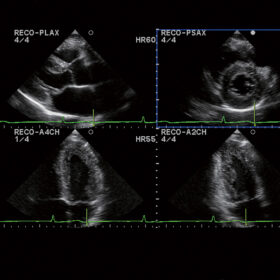 Dormed Hellas Aloka Prosound ALPHA6