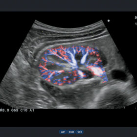 Dormed Hellas A6 - Kidney eFlow