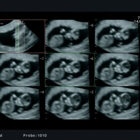 Dormed Hellas Aloka Prosound ALPHA6