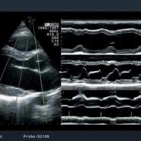 Dormed Hellas Aloka Prosound ALPHA7