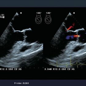 Dormed Hellas Aloka Prosound ALPHA7