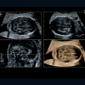 Dormed Hellas Aloka Prosound ALPHA7