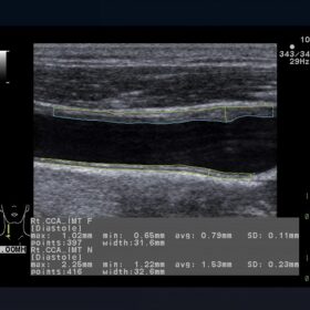 Dormed Hellas Aloka Prosound ALPHA7
