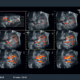 Dormed Hellas A7 - Kindey Flow MSI