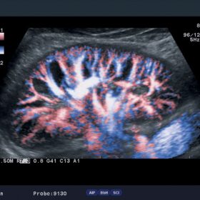 Dormed Hellas A7 - Kindey eFlow