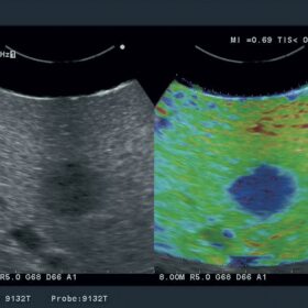 Dormed Hellas A7 - Liver Elasto