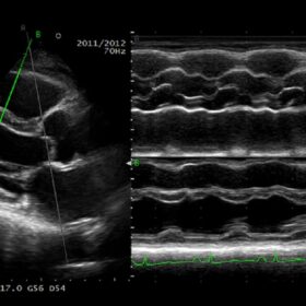 Dormed Hellas 50 Ultrasound