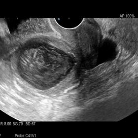Dormed Hellas AR60 - Gynecology