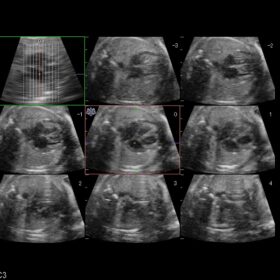 Dormed Hellas AR60 - Obst