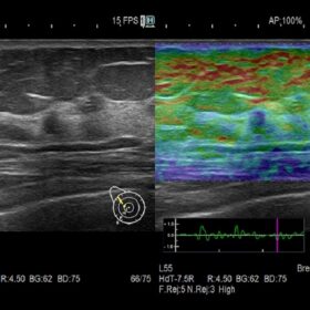 Dormed Hellas AR65 - Breast RTE